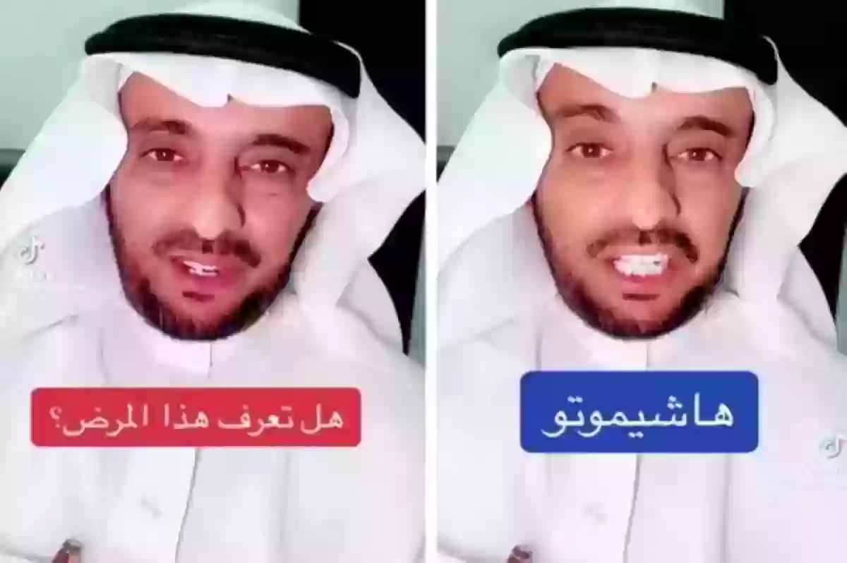 طبيب سعودي يتحدث عن «مرض هاشيموتو»